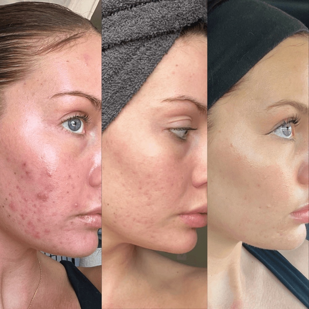 NEW‼️ 10% Vitamin C + Squalane Repair Cream - Hyperpigmentation, Acne, Wrinkles - Picture 8 of 11